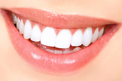 Offering Services: Teeth Whitening (3 Sessions)