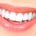 Ofreciendo Servicios: Teeth Whitening (3 Sessions)