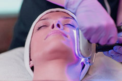 Offering Services: Acne blue light therapy - Normally $95