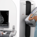 Services (Per event pricing): Mobile Mammograms