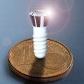 Information: Dental Implants : How does it work ?