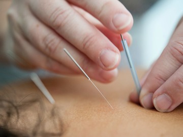 Services (Per Hour Pricing): Acupuncture