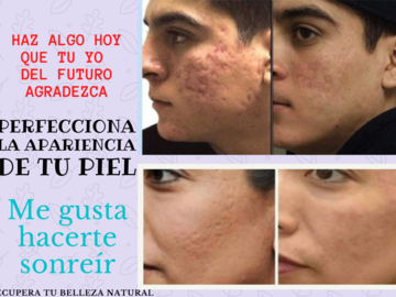 Productos : Recupera tu belleza natural!