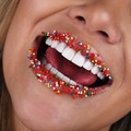 Productos: Diseño de sonrisa en resina de alta estetica