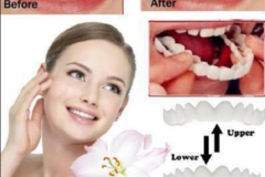 Buy Now: 50PCS Dentures Braces Instant Smile Comfort Fit