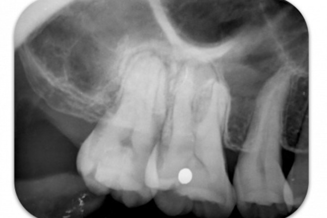 meX+DentX