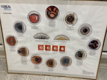 Selling with online payment: Framed Eye Anatomy/Ocular Disease Posters