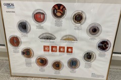 Selling with online payment: Framed Eye Anatomy/Ocular Disease Posters