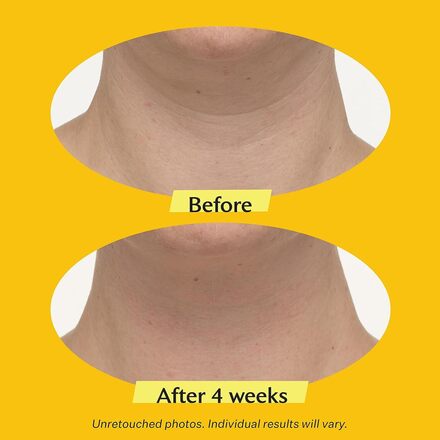 StriVectin TL Advanced Tightening Neck Cream Plus 0.25 OZ- 24pc
