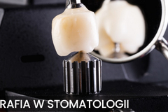 Kurs: DOKUMENTACJA FOTOGRAFICZNA W STOMATOLOGII - II EDYCJA – WRZESIEŃ 
