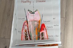 Nieuwe apparatuur: Diverse dental poosters
