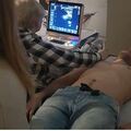 Course: Ultrasonografia układu oddechowego – coś więcej niż BLUE Protocol