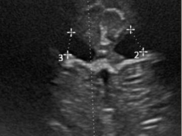 Kurs: CHOROBY I WADY WRODZONE W DIAGNOSTYCE ULTRASONOGRAFICZNEJ