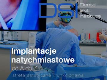 Kurs: Implantacje natychmiastowe od A do Z – strefa estetyczna i funkcj