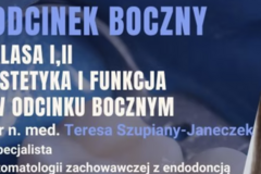Kurs: Odcinek boczny - odbudowa kompozytowa klasy I i II