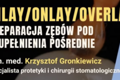 Kurs: Preparacja zębów pod uzupełnienia pośrednie