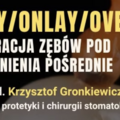 Kurs: Preparacja zębów pod uzupełnienia pośrednie
