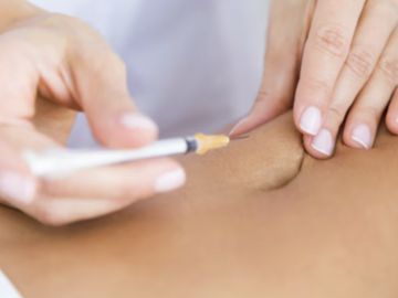 Kurs: Lipoliza iniekcyjna