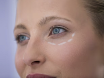 Kurs: BLEFAROPLASTYKA POWIEK GÓRNYCH