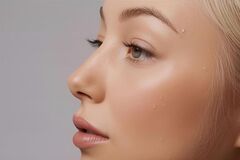 Renting out:  Vancouver,Advanced Skin Treatments & 3D Skin Scan in Vancouver