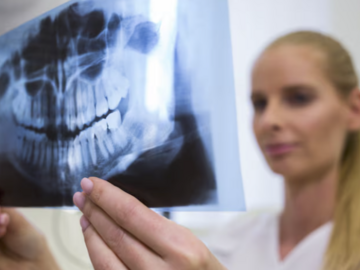 Kurs: Seplenienie międzyzębowe i boczne a dysfunkcje w obszarze orofacj