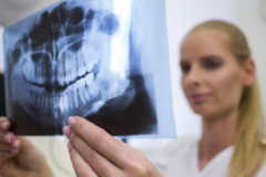 Kurs: Seplenienie międzyzębowe i boczne a dysfunkcje w obszarze orofacj