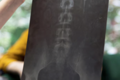 Darmowy kurs (ogłoszenie): Dostępy i stabilizacje przednie kręgosłupa lędźwiowego- ALIF, XLI