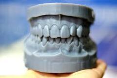 Artikel gevraagd: ortho studie modellen 