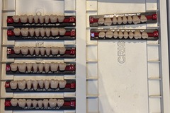 Gebruikte apparatuur: Myerson kiezen, onder en boven: 48 sets in div kleuren