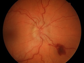 Selling with online payment: NIDEK AFC-230 Non-Mydriatic Fundus Camera – Fully Functional