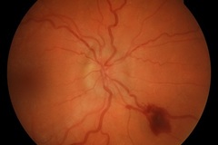 Selling with online payment: NIDEK AFC-230 Non-Mydriatic Fundus Camera – Fully Functional