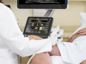 Kurs: Kurs USG żył kończyn dolnych – ultrasonografia żylna (Doppler)