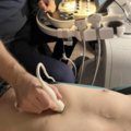 Kurs: USG DOPPLER NACZYŃ JAMY BRZUSZNE