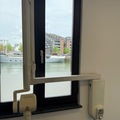 Gebruikte apparatuur: MR Dental | Carestream | CS 2200 | Röntgen