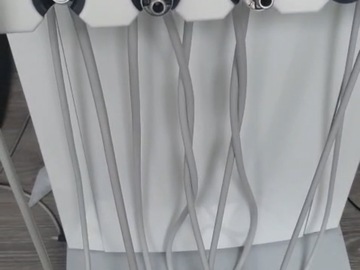 Gebruikte apparatuur: DSA mobiele tandheelkundige behandelunit